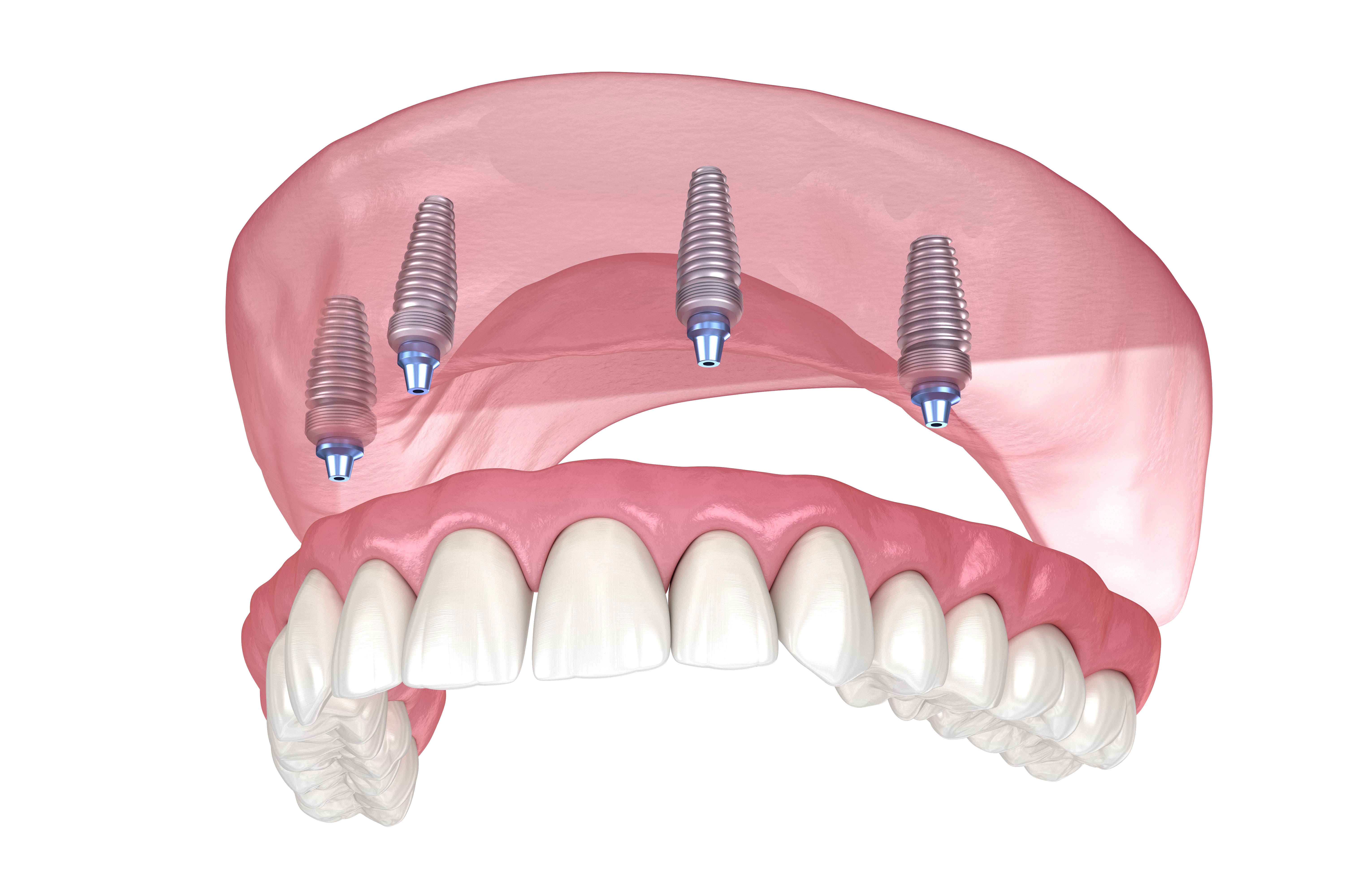 mouthpiece