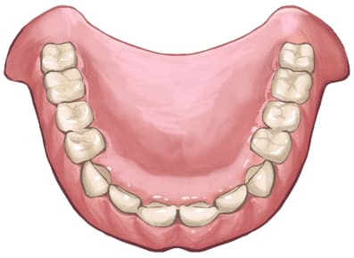 mouthpiece