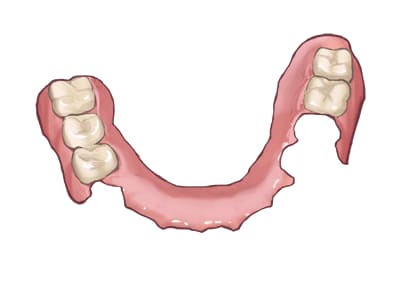 mouthpiece
