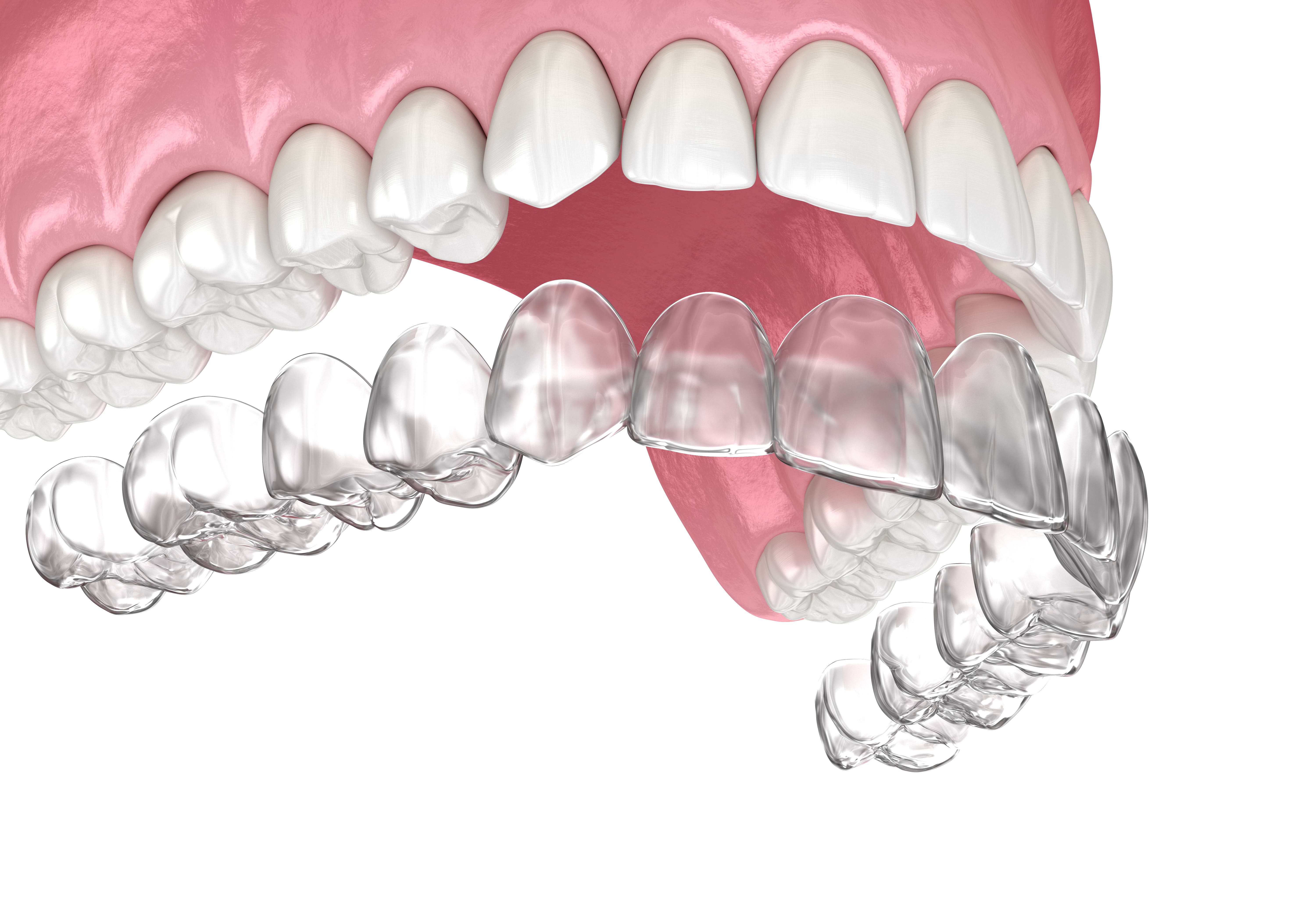 mouthpiece