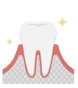 caries