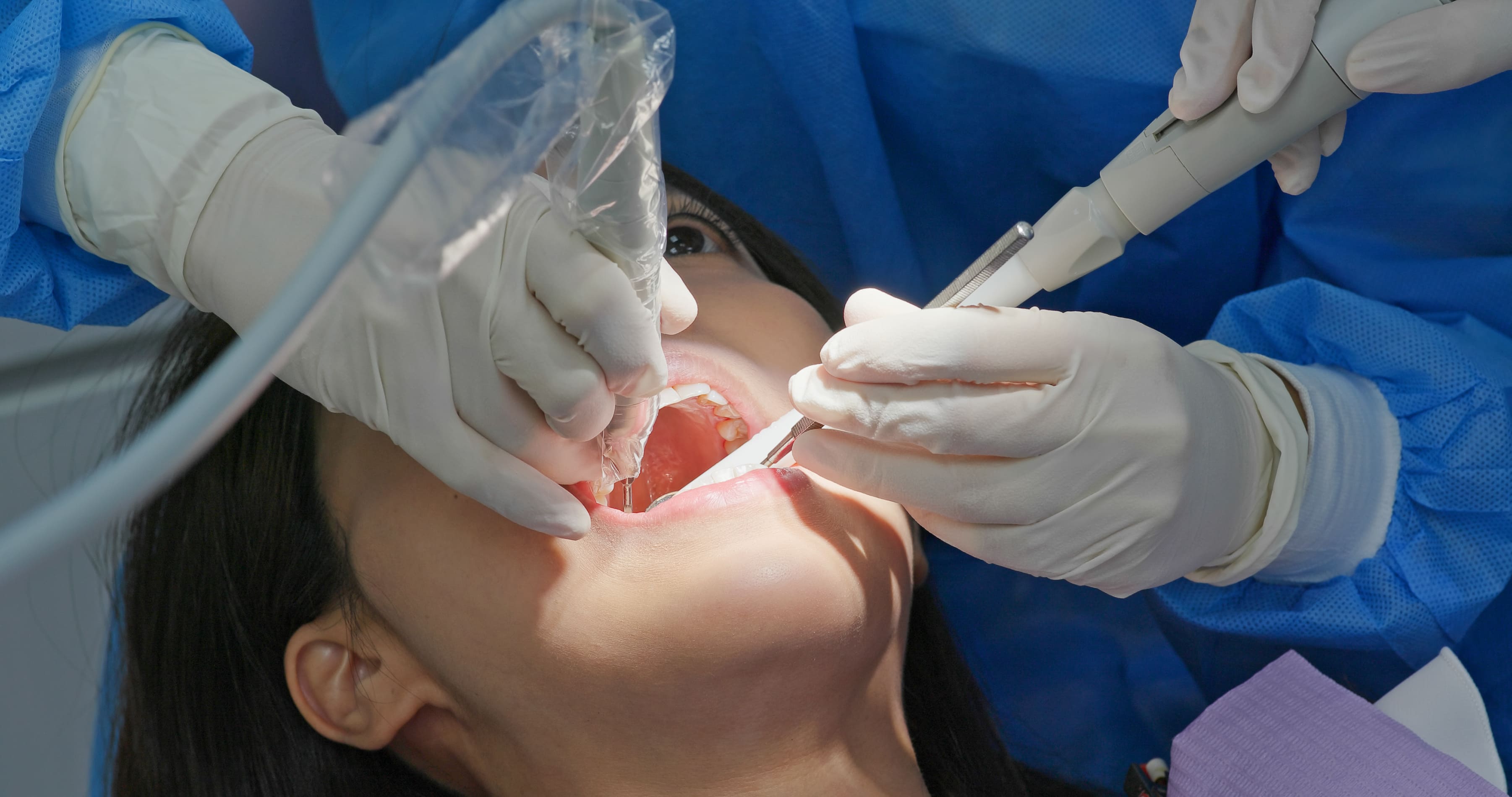 caries