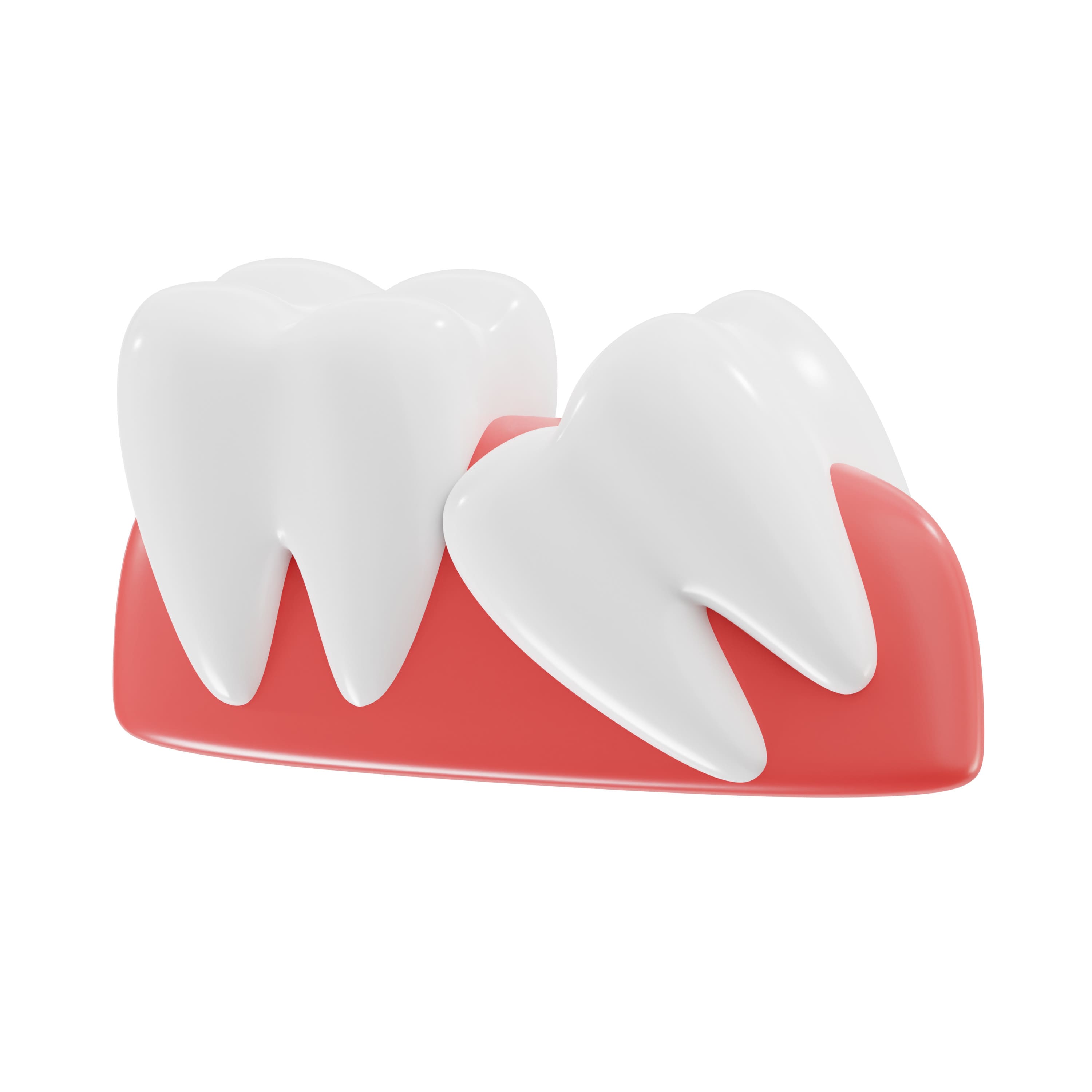 caries